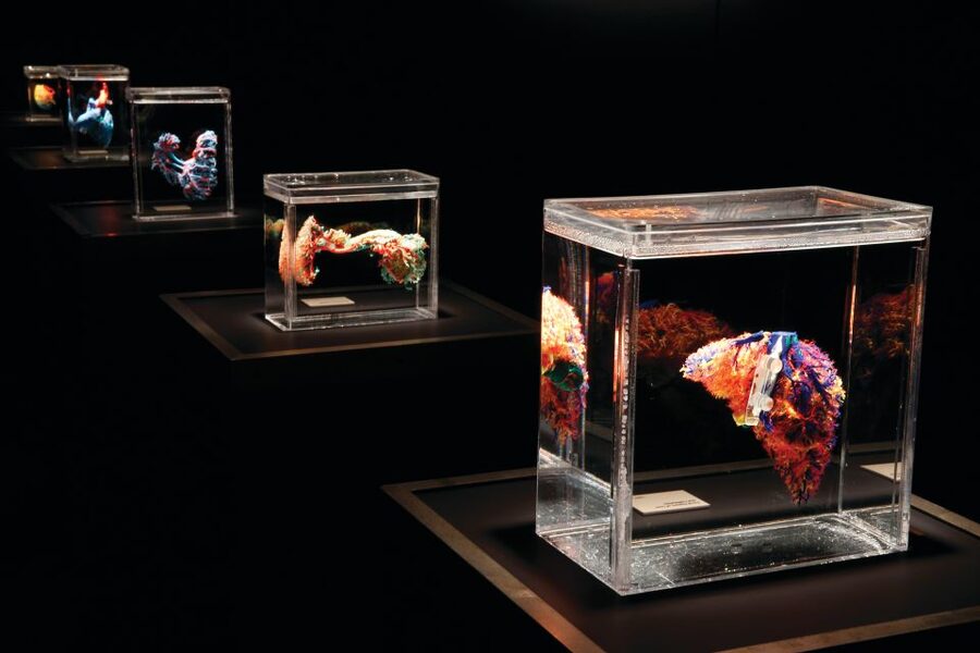 Las Vegas: BODIES | The Exhibition at the Luxor - What BODIES at Luxor actually shows you